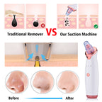 Multi-Functional Blackhead Remover Vacuum Tool For Pore Cleansing And Acne Treatment