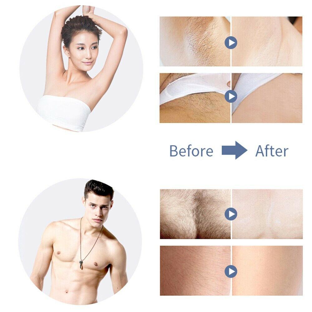 Electric Dry Women Lady Body Hair Remover Cutter Safety Painless Epilator AU