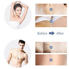 Electric Dry Women Lady Body Hair Remover Cutter Safety Painless Epilator AU