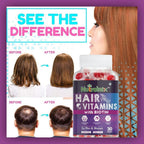 BAVI Biotin Hair Vitamins Gummies for Healthy Hairs, Glowing Skin and Shiny Nails | for Men and Women - 30 Vegetarian Gummies