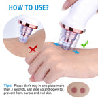 Multi-Functional Blackhead Remover Vacuum Tool For Pore Cleansing And Acne Treatment