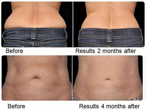 Dermapeel Home Laser Lipo Professional Machine Belt Fat Cell Reduction Cavitation Liposuction Loss Women & Men Detox Lose Inches Slimming Cellulite Fat Removal Burner Light Body Shaping Weight Loss