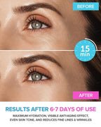 Maree Eye Gel Pads - Reduce Wrinkles, Puffy Eyes, Dark Circles, Eye Bags - Natural Marine Collagen Eye Gels with Hyaluronic HA - Anti Aging Eye Mask Patches &amp; Face Moisturizer